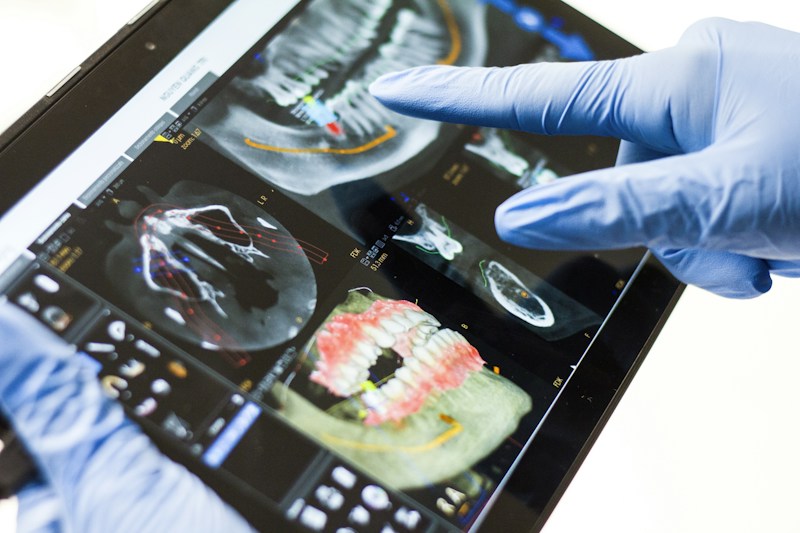 Implantes Dentários e Cirurgia Oral Avançada